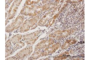 Immunoperoxidase of purified MaxPab antibody to MPPED1 on formalin-fixed paraffin-embedded human stomach.