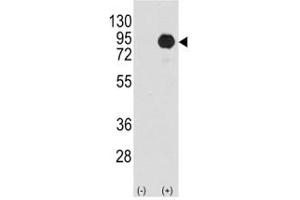 Western Blotting (WB) image for anti-B-Raf proto-oncogene, serine/threonine kinase (BRAF) (AA 424-453) antibody (ABIN3029542)