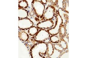 Immunohistochemical analysis of paraffin-embedded H. (MPP7 抗体  (N-Term))