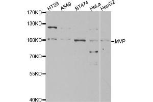 Western blot analysis of extracts of various cell lines, using MVP antibody. (MVP 抗体)
