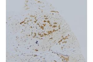 ABIN6273025 at 1/100 staining Human lung tissue by IHC-P. (VPS33B 抗体)