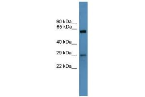 WB Suggested Anti-TP53RK Antibody Titration: 0. (TP53RK 抗体  (N-Term))