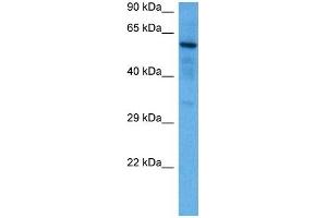 Host:  Rabbit  Target Name:  SOX9  Sample Tissue:  Mouse Brain  Antibody Dilution:  1ug/ml (SOX9 抗体  (N-Term))