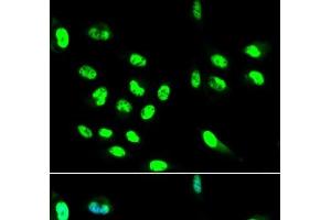 Immunofluorescence analysis of HepG2 cells using FCGR2A Polyclonal Antibody (FCGR2A 抗体)