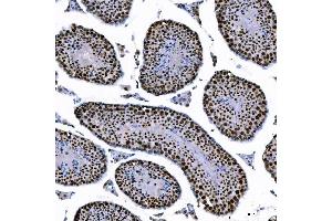 IHC analysis of SAE1 using anti-SAE1 antibody (ABIN7601346).