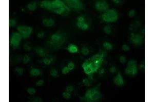 Image no. 4 for anti-Tumor Protein P53 (TP53) antibody (ABIN1499971) (p53 抗体)