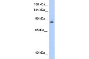 Western Blotting (WB) image for anti-Aconitase 1 (ACO1) antibody (ABIN2462120) (Aconitase 1 抗体)