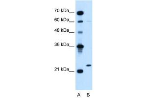 WB Suggested Anti-IGLL1  Antibody Titration: 5. (IGLL1 抗体  (N-Term))