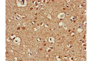 Immunohistochemistry of paraffin-embedded human brain tissue using ABIN7145099 at dilution of 1:100 (ATG13 抗体  (AA 315-517))