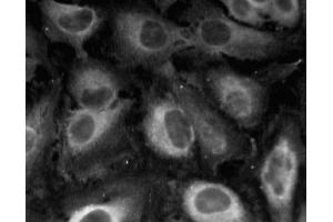 Immunofluorescent staining of HeLa (ATCC CCL-2) cells. (Caveolin-1 抗体  (AA 1-97))
