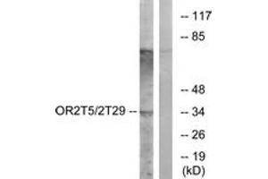 Western blot analysis of extracts from K562 cells, using OR2T5/2T29 Antibody. (OR2T5/2T29 抗体  (AA 66-115))