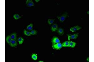 Immunofluorescence (IF) image for anti-ATPase, H+/K+ Transporting, Nongastric, alpha Polypeptide (ATP12A) (AA 171-306) antibody (ABIN7164023)