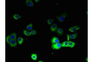 Immunofluorescent analysis of A431 cells using ABIN7164023 at dilution of 1:100 and Alexa Fluor 488-congugated AffiniPure Goat Anti-Rabbit IgG(H+L) (ATP12A 抗体  (AA 171-306))