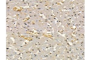 ABIN7097059 and ABIN7101126 at 1/100 staining rat heart tissue by IHC-P.