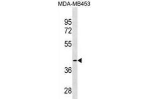 Western Blotting (WB) image for anti-Cysteine-S-conjugate beta-Lyase (CCBL1) antibody (ABIN3000294) (CCBL1 抗体)