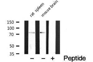 Western blot analysis of extracts of various tissue sample,using CLIP4 Antibody . (CLIP4 抗体  (Internal Region))