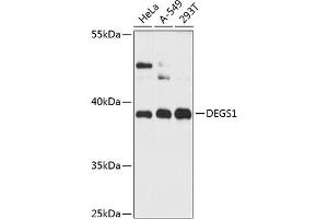 Western blot analysis of extracts of various cell lines, using DEGS1 antibody (ABIN6133275, ABIN6139528, ABIN6139529 and ABIN6216357) at 1:3000 dilution. (DEGS1 抗体  (AA 234-323))