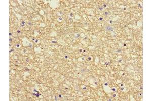 Immunohistochemistry of paraffin-embedded human brain tissue using ABIN7144042 at dilution of 1:100 (APP 抗体  (AA 18-270))