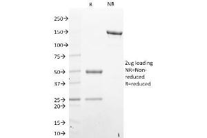 SDS-PAGE Analysis Purified STAT6 Mouse Monoclonal Antibody (STAT6/2410). (STAT6 抗体)