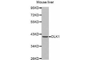 Western Blotting (WB) image for anti-delta-Like 1 Homolog (Drosophila) (DLK1) antibody (ABIN6219768) (DLK1 抗体)