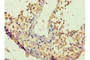 Immunohistochemistry analysis of paraffin-embedded (BACH1 抗体  (AA 1-320))