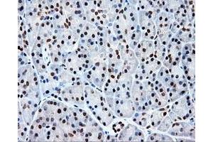 Immunohistochemical staining of paraffin-embedded colon tissue using anti-KIAA1609 mouse monoclonal antibody. (KIAA1609 抗体)