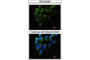 Image no. 2 for anti-Tyrosyl-tRNA Synthetase (Yars) (AA 357-520) antibody (ABIN467437) (YARS 抗体  (AA 357-520))