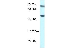 Western Blot showing PUS1 antibody used at a concentration of 1 ug/ml against Jurkat Cell Lysate (PUS1 抗体  (N-Term))