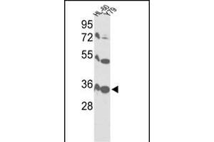 Western blot analysis of VDAC1 Antibody (Center) (ABIN390564 and ABIN2840894) in HL-60, Y79 cell line lysates (35 μg/lane). (VDAC1 抗体  (AA 95-124))