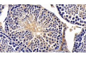 Detection of AMH in Mouse Testis Tissue using Monoclonal Antibody to Anti-Mullerian Hormone (AMH) (AMH 抗体  (AA 453-560))