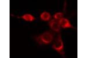 ABIN6274423 staining Hela cells by IF/ICC. (FUK 抗体  (N-Term))