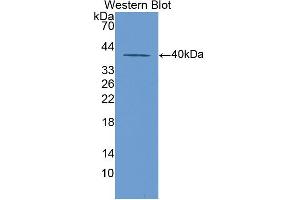 Western blot analysis of the recombinant protein. (KRT20 抗体  (AA 75-382))