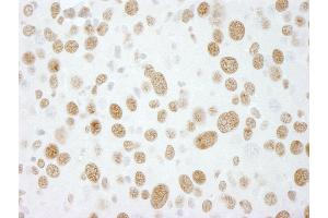 Immunohistochemistry (IHC) image for anti-RNA-binding protein Raly (RALY) (AA 256-306) antibody (ABIN7448753)