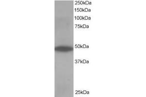 Western Blotting (WB) image for anti-Oxysterol Binding Protein-Like 1A (OSBPL1A) antibody (ABIN5929821) (OSBPL1A 抗体)