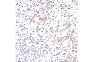 anti-Apoptosis Inhibitor 5 (API5) (AA 1-50) antibody