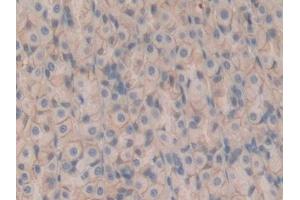 Detection of CD147 in Rat Stomach Tissue using Polyclonal Antibody to Cluster Of Differentiation 147 (CD147) (CD147 抗体  (AA 59-321))