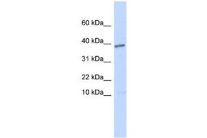 WB Suggested Anti-LEFTY1 Antibody Titration: 0. (LEFTY1 抗体  (N-Term))