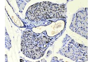 IHC analysis of COPE using anti-COPE antibody . (COPE 抗体  (AA 80-308))