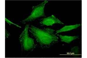 Immunofluorescence (IF) image for anti-Heat Shock Transcription Factor, Y Linked 2 (HSFY2) (AA 1-100) antibody (ABIN531105)