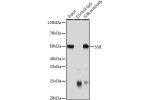Immunoprecipitation (IP) image for anti-Sjogren Syndrome Antigen B (SSB) (AA 166-408) antibody (ABIN3015265)