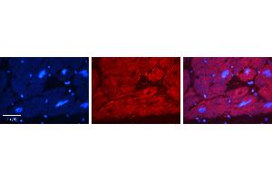 Immunohistochemistry (IHC) image for anti-Ewing Sarcoma Breakpoint Region 1 (EWSR1) (N-Term) antibody (ABIN2779046)