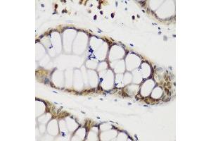 Immunohistochemistry of paraffin-embedded human gastric using NCL antibody at dilution of 1:200 (40x lens). (Nucleolin 抗体)