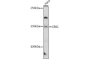 Western blot analysis of extracts of HeLa cells, using CRB1 antibody (ABIN7266524) at 1:1000 dilution. (CRB1 抗体  (AA 20-200))