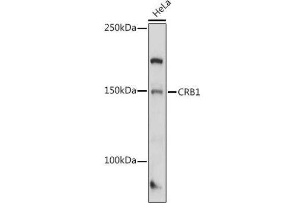 CRB1 抗体  (AA 20-200)