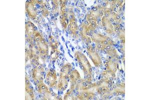 Immunohistochemistry of paraffin-embedded rat kidney using CRYAA antibody at dilution of 1:200 (40x lens). (CRYAA 抗体)