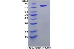 SDS-PAGE (SDS) image for Solute Carrier Family 27 (Fatty Acid Transporter), Member 5 (SLC27A5) protein (ABIN3009353)