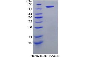SDS-PAGE analysis of Rat FATP5 Protein. (SLC27A5 蛋白)