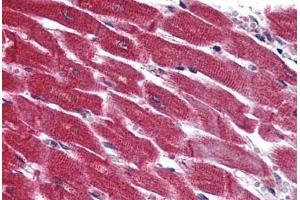 Anti-EDG3 / S1P3 antibody  ABIN1048532 IHC staining of human heart. (S1PR3 抗体  (N-Term))