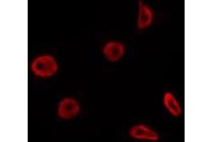 ABIN6275805 staining Hela by IF/ICC. (Topoisomerase I 抗体  (Internal Region))
