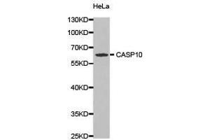 Western Blotting (WB) image for anti-Caspase 10, Apoptosis-Related Cysteine Peptidase (CASP10) antibody (ABIN1871452) (Caspase 10 抗体)